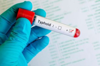 Antibiotic resistance fuels 87 per cent of India's typhoid economic burden: Study