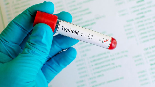 Antibiotic resistance fuels 87 per cent of India's typhoid economic burden: Study