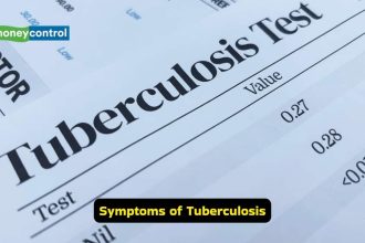 National Tuberculosis Day 2026: Know the symptoms of TB and simple ways to prevent the disease