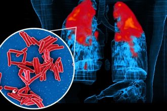 Preventable TB deaths remain India’s biggest challenge: Soumya Swaminathan