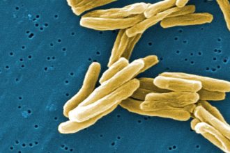 Research identifies new mechanisms to detect and weaken TB bacteria