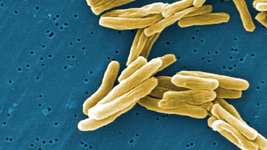 Research identifies new mechanisms to detect and weaken TB bacteria