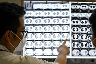 UN observes World Tuberculosis Day on March 24