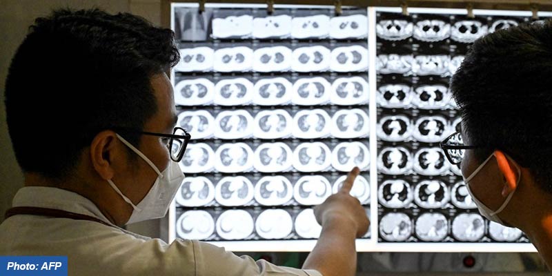 UN observes World Tuberculosis Day on March 24