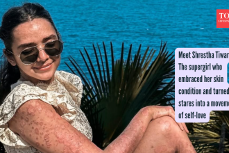 Meet Shrestha Tiwari: The supergirl who embraced her skin condition and turned stares into a movement of self-love