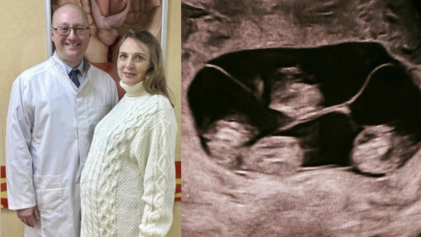 ‘One in 15.5 million’: Woman in Russia gives birth to four identical girls