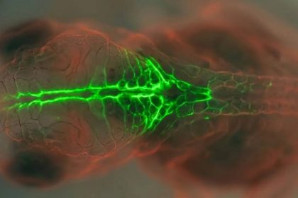 PRICKLE1 protein study uses glowing embryos to understand birth defects