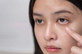 Puffy eyes that won’t go away? Why it could signal kidney trouble, and when to get tested