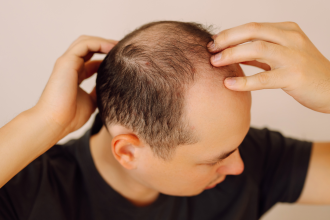 Scientists develop plant-based serum that regrows hair within weeks