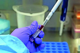 India tightens screening after 2 suspected Ebola cases surface