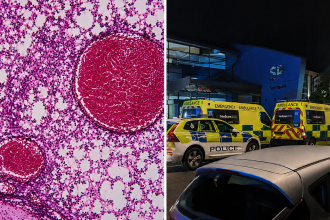 Meningitis outbreak sparks alarm after student dies and 2 others fall ill in Reading Area