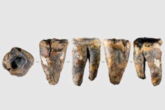 Neanderthal Dental Surgery Found: Study reveals drilled molar and survival; reshapes view of empathy