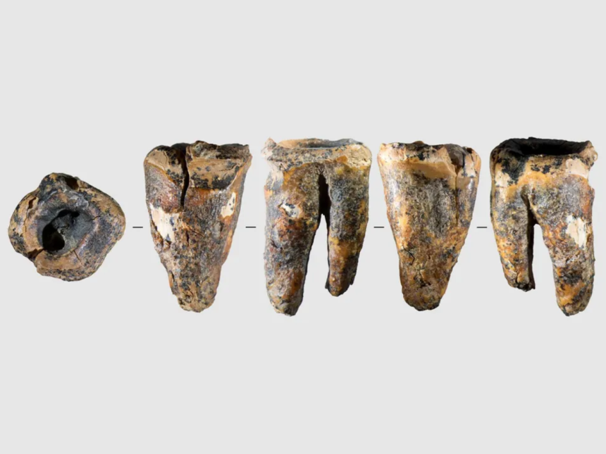Neanderthal Dental Surgery Found: Study reveals drilled molar and survival; reshapes view of empathy
