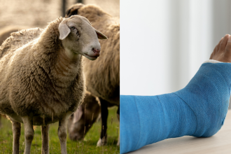 Scientists turn sheep wool into a bone-healing material in a major medical breakthrough