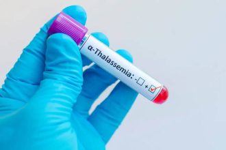 Silent Thalassemia carriers: Doctor explains hidden genetic risk many Indians don’t know about
