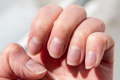 The body check: What your fingernails may reveal about health