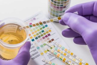 The body check: Your urine colour could be warning you about hidden health problems, what every shade really means