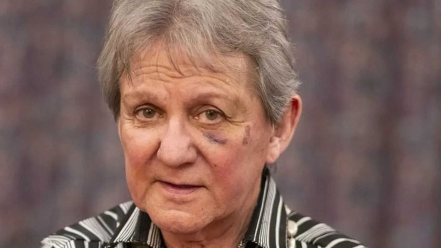 TV antiques expert decides to close iconic jewellery shop, leave London after hammer attack during robbery