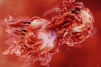 We wait for pain, but cancer often starts without it