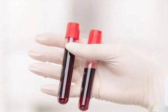 World’s rarest hybrid blood type discovered in Thailand: Study found in just 3 people out of a massive research of 544,000