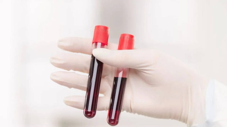World’s rarest hybrid blood type discovered in Thailand: Study found in just 3 people out of a massive research of 544,000
