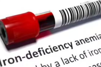 Anaemia data missing from NFHS-6 fact sheets; govt says new survey will fill gap