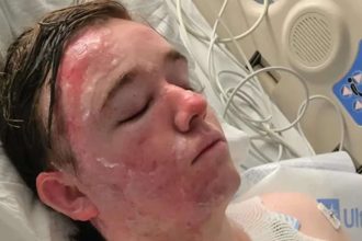 McDonald’s worker left in ICU after colleague throws scalding oil on him in California