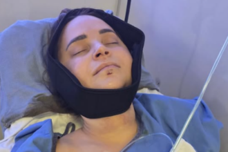 YouTuber Rosanna Pansino undergoes surgery after breaking jaw in boat accident