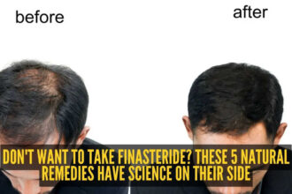 5 natural alternatives to Finasteride that could help with hair growth