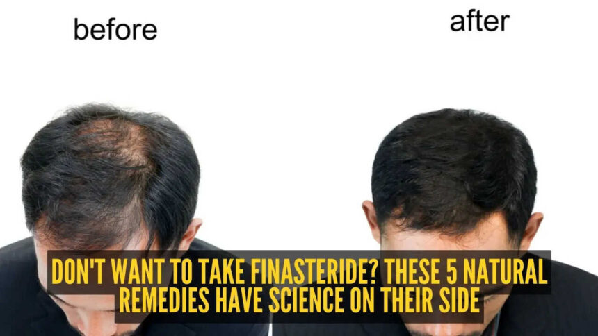 5 natural alternatives to Finasteride that could help with hair growth
