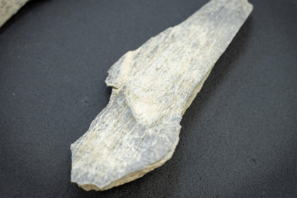 A sharp stone tool cut this early human's jaw 100,000 years ago, but the healed bone shows he survived