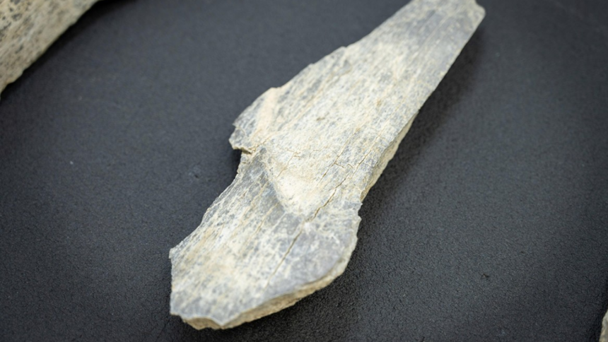 A sharp stone tool cut this early human's jaw 100,000 years ago, but the healed bone shows he survived