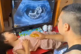 Father tricks daughter with fake ultrasound to stop her from eating junk food