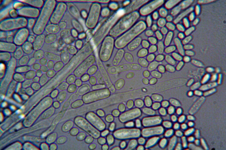 German scientists discovered naturally occurring microbes that removed 95% of dissolved uranium from contaminated water
