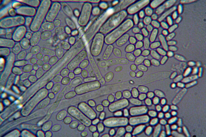 German scientists discovered naturally occurring microbes that removed 95% of dissolved uranium from contaminated water