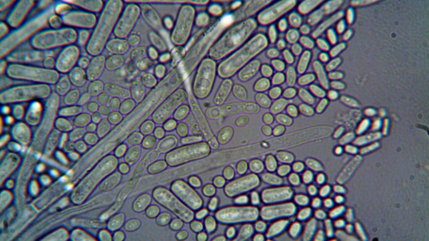 German scientists discovered naturally occurring microbes that removed 95% of dissolved uranium from contaminated water