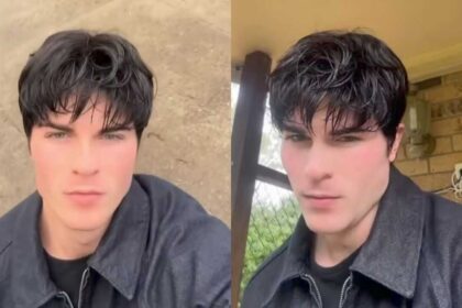 Is Nocturnal Kent dead? Looksmaxxing streamer sparks concern after alleged brain aneurysm rumors