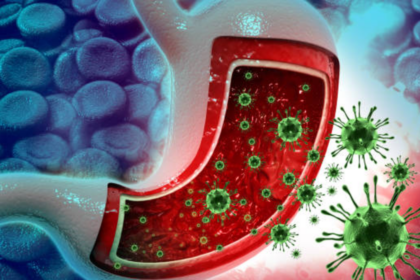 US Cyclospora (diarrhea parasite) outbreak raises monsoon health concerns: Can India be at risk too?