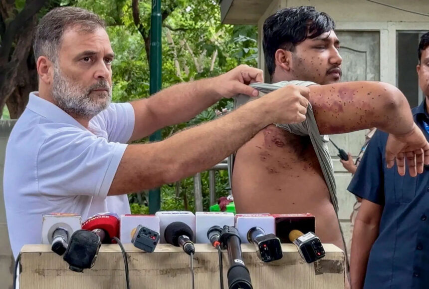 'Who approved pellet guns?' Rahul Gandhi writes Amit Shah over 'barbaric assault' on students