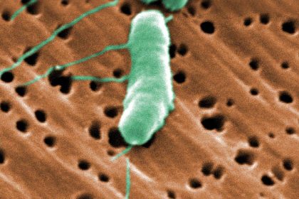 Florida's first flesh-eating bacteria death of 2026 raises concerns during beach season as warm waters fuel infections