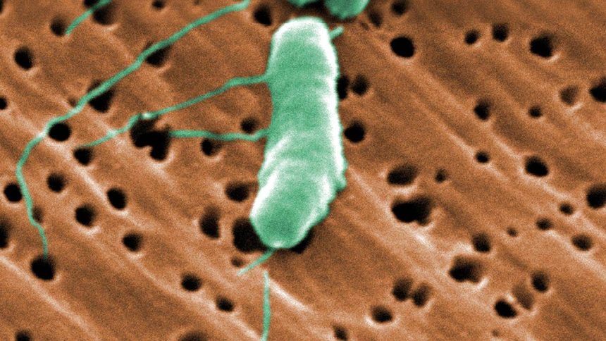 Florida's first flesh-eating bacteria death of 2026 raises concerns during beach season as warm waters fuel infections